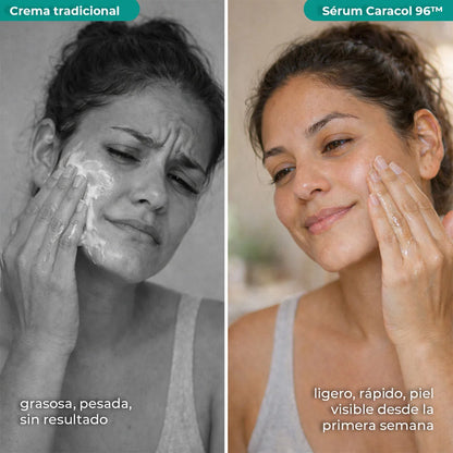 Sérum Caracol 96™ · Piel hidratada, suave y luminosa… sin complicarte la vida.